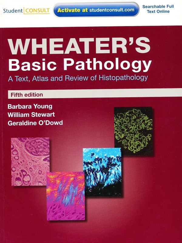 Wheaters Basic Pathology 5e/Barbara Young